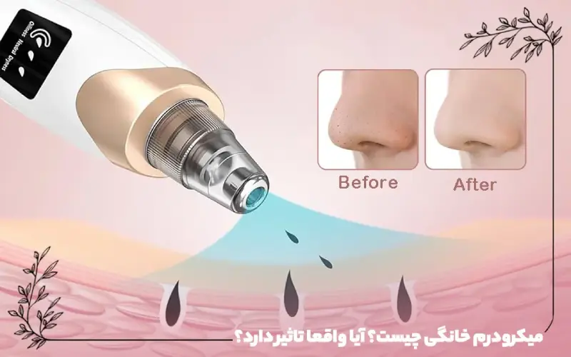میکرودرم